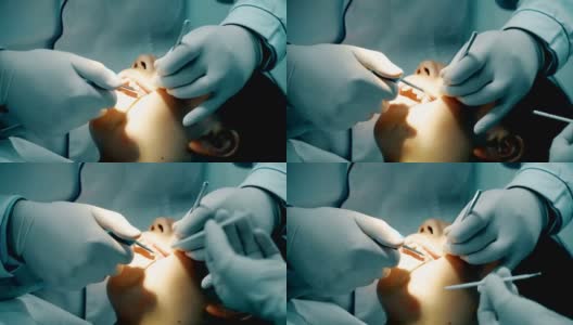 牙科医生正在给病人补牙高清在线视频素材下载