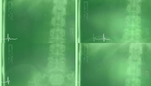 医学背景3:脊柱右侧，绿色高清在线视频素材下载