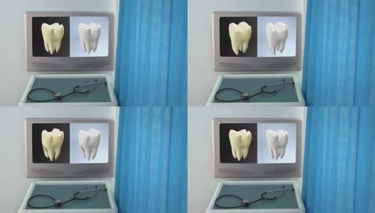 牙齿对比医学屏幕特写高清在线视频素材下载