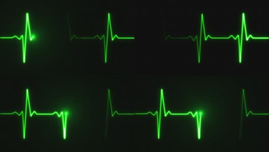 心跳的脉搏是绿色的高清在线视频素材下载