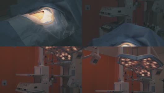 手术室灯亮，向上倾斜高清在线视频素材下载