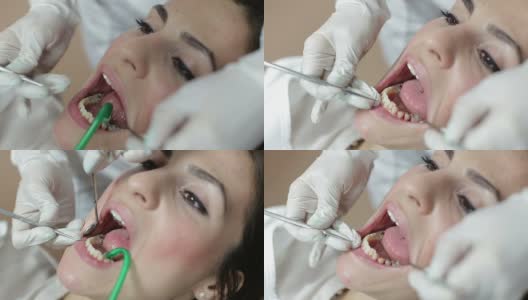 修补病人的牙齿高清在线视频素材下载