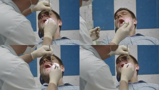 牙科医生正在看病人的牙齿高清在线视频素材下载