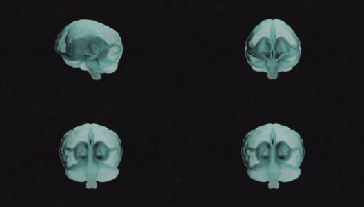 大脑解剖。真实的人类大脑在绿色阴影旋转在黑色的o背景。高清在线视频素材下载