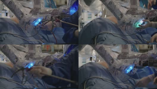 达芬奇手术系统的微创机器人手术高清在线视频素材下载