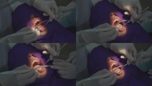 牙科医生清洁口腔内的牙垢高清在线视频素材下载