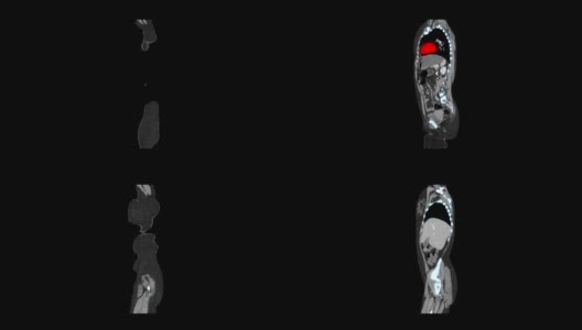 MRI扫描医学筛查高清在线视频素材下载