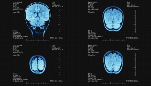 MRI大脑扫描未来的蓝色显示高清在线视频素材下载