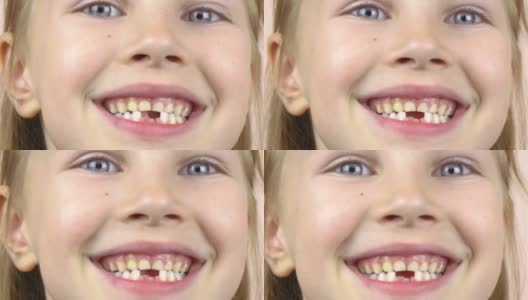 这是一个小女孩的特写，她的嘴露出了脱落的乳牙，做着鬼脸。高清在线视频素材下载