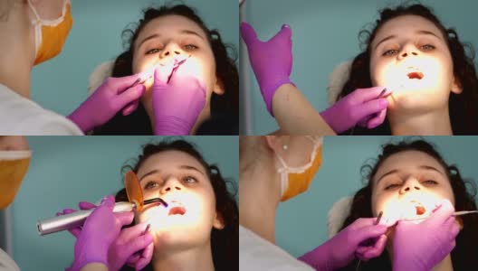 牙科医生用紫外光灯对十几岁的女性进行陶瓷填充高清在线视频素材下载