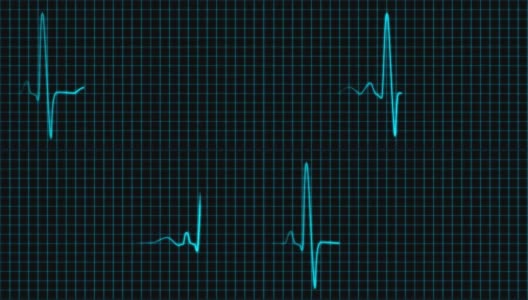 心电图示波器屏幕带栅格蓝色回路高清在线视频素材下载