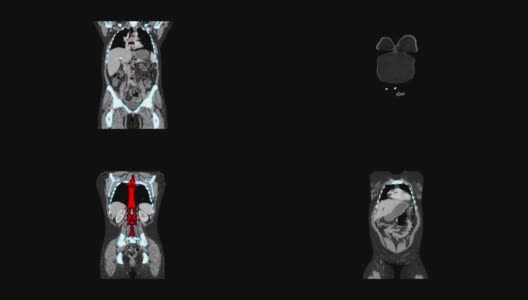 医学MRI影像筛检，CT或CAT扫描仪高清在线视频素材下载