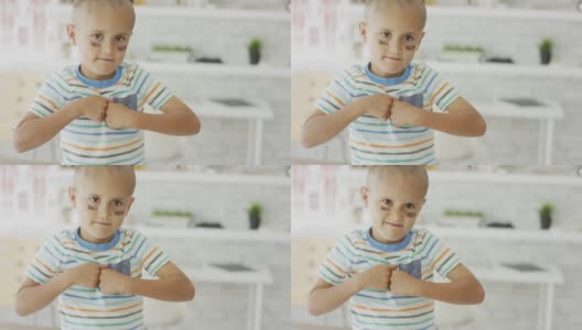 患有癌症的小男孩摆出一副“战斗”的面孔高清在线视频素材下载